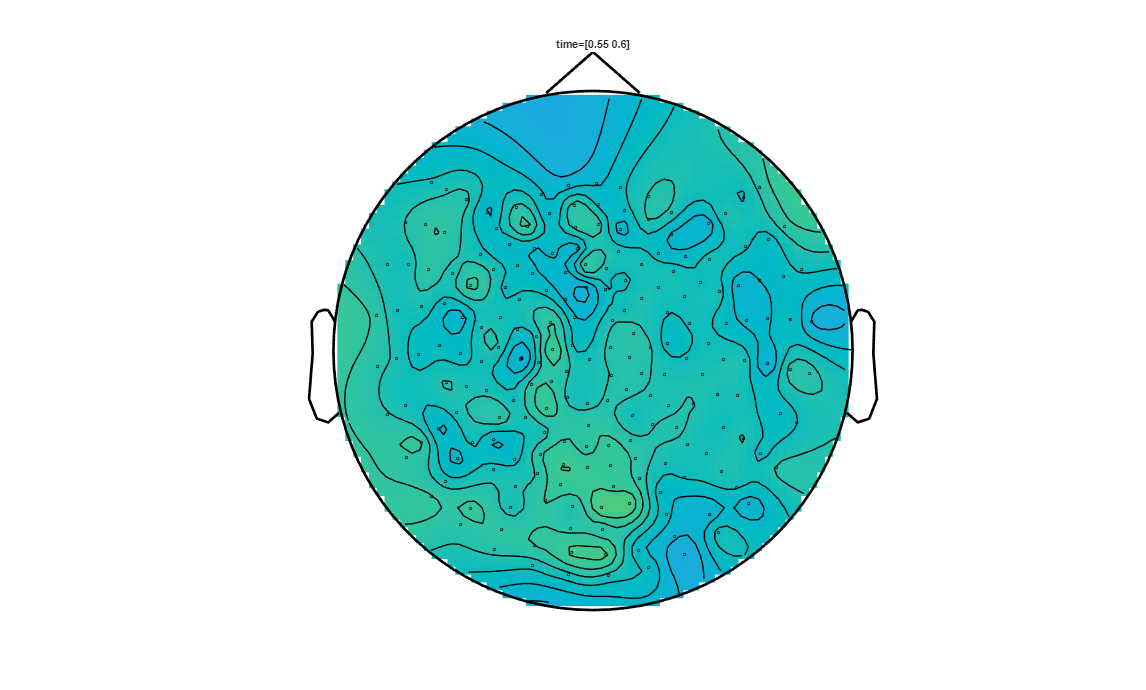 ../../../_images/6-meg-pipeline-gallery_notebooks_fieldtrip_fieldtrip_kit_spatio-temporal-clustering_23_12.png