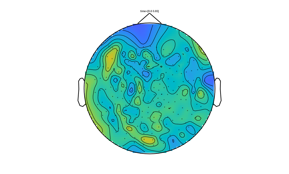 ../../../_images/6-meg-pipeline-gallery_notebooks_fieldtrip_fieldtrip_kit_spatio-temporal-clustering_33_14.png