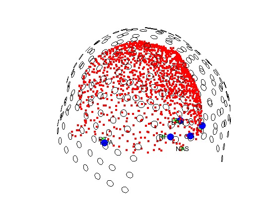 ../../../_images/6-meg-pipeline-gallery_notebooks_fieldtrip_fieldtrip_oddball_KIT_pipeline_45_0.png