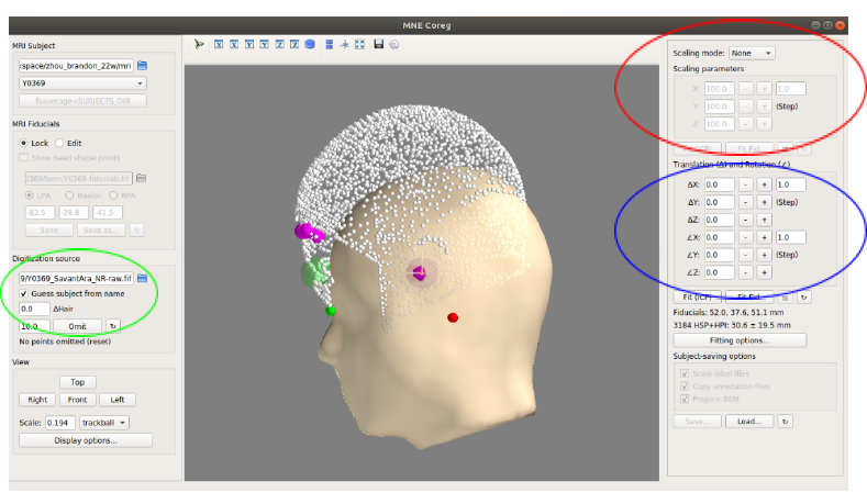 AI generated MEG-system image